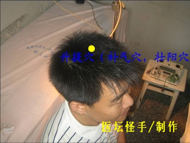 王文遠(yuǎn)平衡針灸穴位圖 - 3396815 - 3396815博愛(ài)