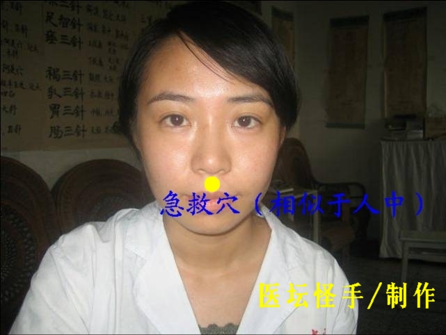 王文遠(yuǎn)平衡針灸穴位圖 - 3396815 - 3396815博愛(ài)