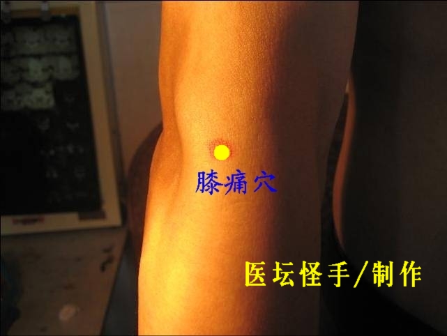 王文遠(yuǎn)平衡針灸穴位圖 - 3396815 - 3396815博愛(ài)