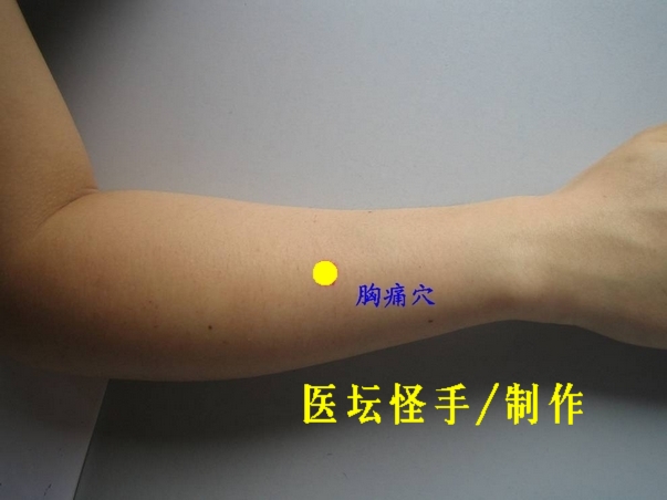 王文遠(yuǎn)平衡針灸穴位圖 - 3396815 - 3396815博愛(ài)