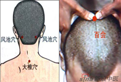 常見病艾灸時怎樣選穴？--大椎百會穴