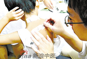 灸法的種類(lèi)  你知道多少？